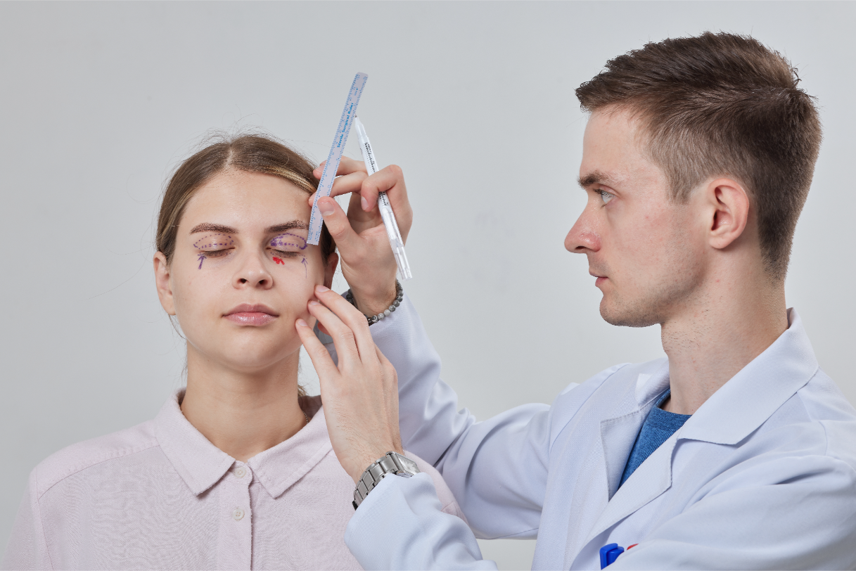 blepharoplasty