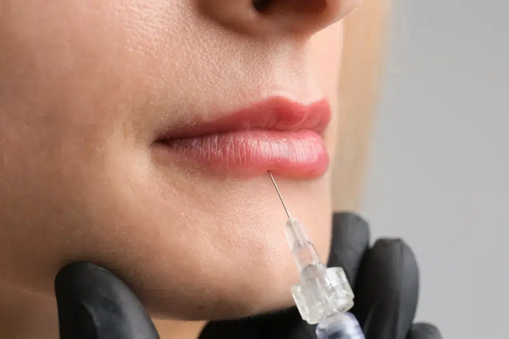 Expert Lip Enhancement 